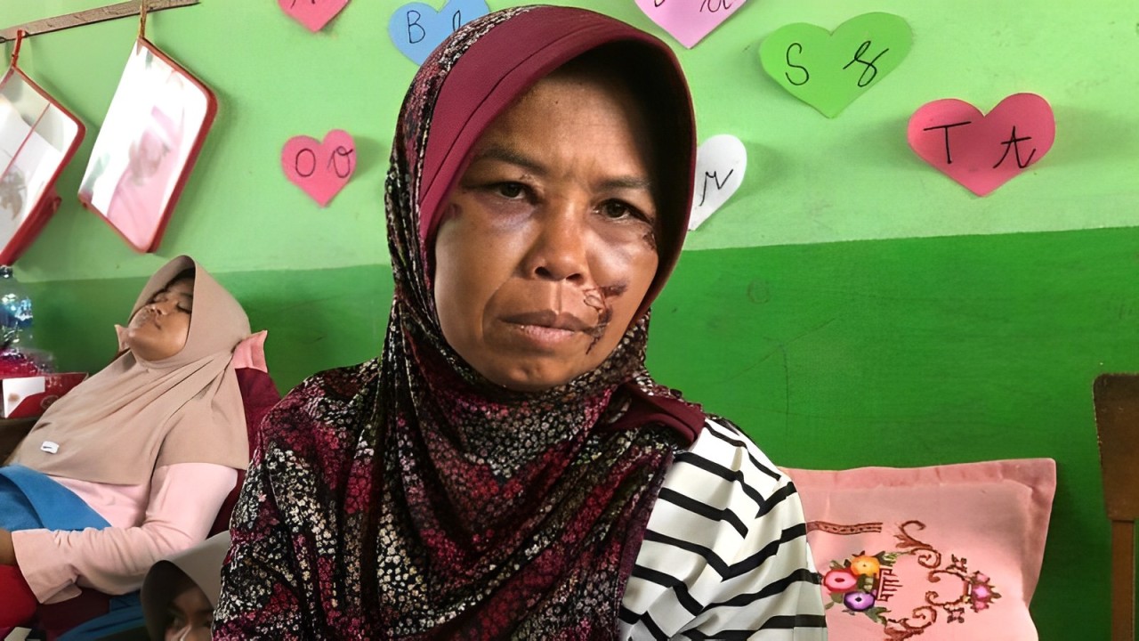 Banjir Bandang Sumbar: 67 Orang Meninggal, Suryati Trauma Kehilangan Anak dan Saudara