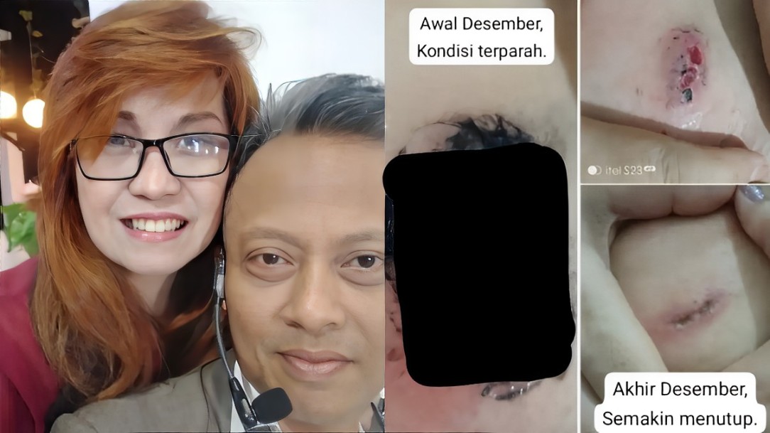 Kesaksian Supranatural: Dioperasi Tuhan, Benjolan di Payudara Sembuh!
